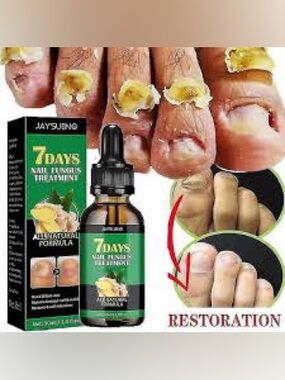 Jaysuing 7Days Nail Fungus Treatment NEW/SEALED‎